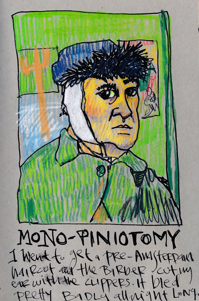 monopiniotomy
